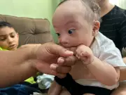 Família de Parnamirim adota bebê com síndrome de Down e cardiopatia após meses em UTI