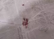 Grávida de cinco meses baleada durante operação policial na Barreira do Vasco, no Rio