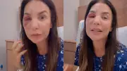 Ivete Sangalo se recupera após cirurgia por fratura facial após desmaio em Salvador