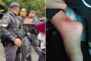 Menino de 3 anos tem pé atropelado por viatura da PM em Santos e policial ameaça família
