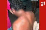Mulher ateia fogo no marido após discussão e agressão em Sorriso (MT)