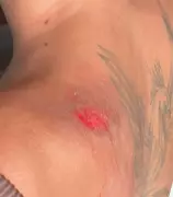 Mulher denuncia perseguição e agressão por mototaxista após desvio de rota em Maceió