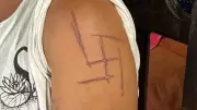 Mulher tem suástica nazista marcada na pele após tortura por patrões e namorado em MS