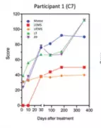 Polilaminina: revistas científicas recusam estudo por divergências em dados e falta de registro