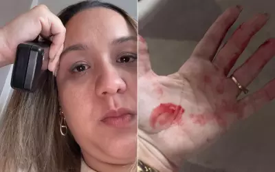 Advogada vive com medo após agressão do ex em Goiânia e denuncia sensação de impunidade