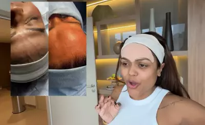 Influenciadora retira veia na testa por estética, mas procedimento gera alerta médico