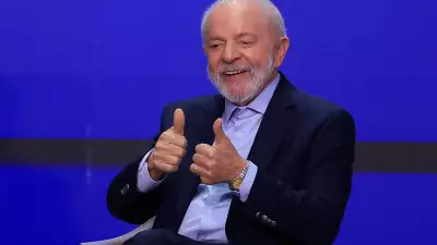 Lula passará por procedimento simples no couro cabeludo e infiltração no punho