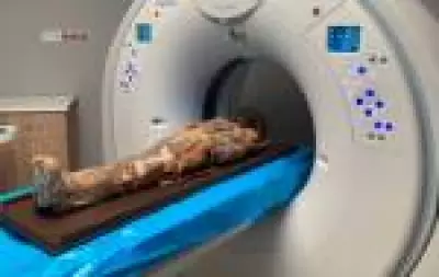 Tomografia revela objeto misterioso no peito de múmia infantil egípcia