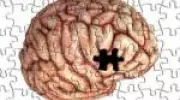 Alzheimer: entenda os estágios da doença que afeta o ex-presidente FHC
