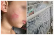 Bebê de um ano internado em UTI após suspeita de agressão por babá em Sorocaba