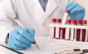 CLT atualizada: empresas agora devem informar sobre direito a folga para exames preventivos de câncer