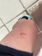 Corredor é perseguido por seis cães durante treino em Bicas, Minas Gerais