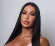 Gracyanne Barbosa revela remoção de preenchimentos faciais e busca por estética natural