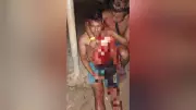 Indígena atacado a facão em aldeia no Pará tem quadro estável, mas com sequelas neurológicas