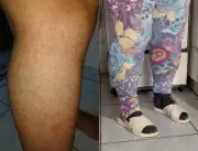 Infestação de maruins transforma rotina em Ilhota (SC) com calor de 34°C