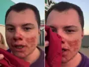 Influencer em coma após agressão em festa universitária de São Carlos