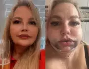 Justiça do Rio impõe tornozeleira eletrônica a dentista após paciente ter rosto deformado