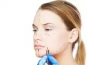 Lifting facial moderno: técnicas profundas e personalizadas para rejuvenescimento natural