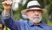 Lula faz procedimento para retirar excesso de pele no couro cabeludo em SP