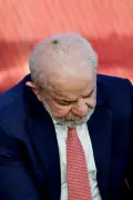 Lula passará por dois procedimentos médicos simples nesta sexta