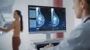 Mamografia sem pedido médico: novo direito na Paraíba