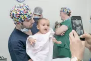 Operação Sorriso abre inscrições para cirurgias gratuitas de fissura labiopalatina em Santarém