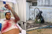 Piloto de paramotor grava vídeo no hospital após cair em quintal de casa em Itanhaém