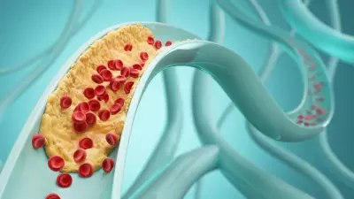 Carboidratos que ajudam a reduzir o colesterol LDL: veja lista