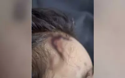 Menina de 2 anos arrastada e casa lavada após espancamento, diz delegado