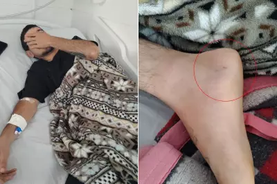 Motoboy é picado por cobra em Praia Grande e passa mal