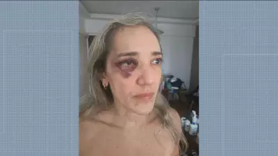 Passageira agredida por motociclista de app na Zona Sul do Rio