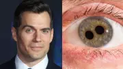 Características raras nos olhos que você nunca imaginou existir