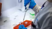 Diversidade genética do SARS-CoV-2 em esgoto prevê casos de Covid com maior precisão