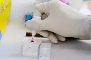 Hepatite A: Juiz de Fora concentra 70% dos casos em Minas Gerais