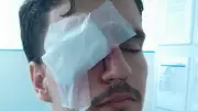 Jovem perde visão após ser atingido por bala de borracha em confusão pós-jogo