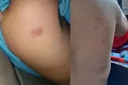 Mãe denuncia professora por hematomas em filho de 2 anos em Sinop