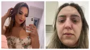 Mulher é espancada por ex-namorado em posto de gasolina na Zona Norte de SP