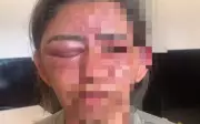 Mulher é estrangulada e espancada até desmaiar por amigo do filho em Cristalina