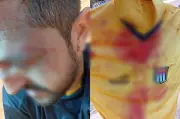 Árbitro é agredido por pais e jogadores em jogo sub-14 em Catanduva
