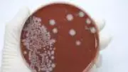 UE barra carne brasileira por uso excessivo de antimicrobianos na pecuária