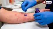 Violeta Genciana: Para que Serve e Como Usar Corretamente