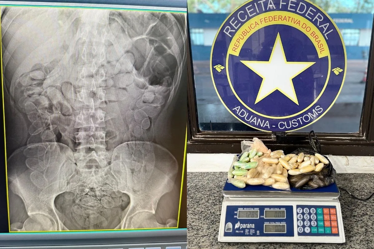 Homem com 90 cápsulas de droga no estômago é preso em operação conjunta em Corumbá