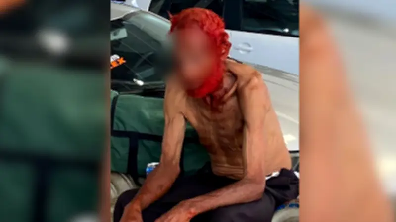 Idoso em situação de rua tem cabelos e barba tingidos à força em Rio Preto