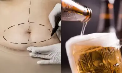 Absorção de álcool quase dobra após cirurgia bariátrica, diz estudo