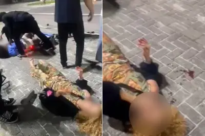 Acidente com patinete em Guarujá deixa duas mulheres feridas