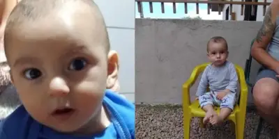 Bebê que recebeu soro antiofídico por engano morre em Joinville