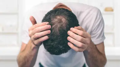 Estresse acelera queda de cabelo? Shampoo com cafeína ajuda