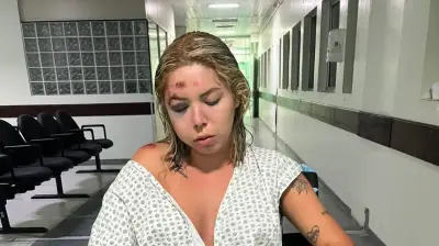 Jovem fratura rosto após ser atropelada por motorista de app em Florianópolis