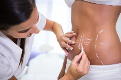 Lipo HD: Nova técnica amplia possibilidades da definição corporal
