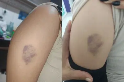 Menina de 11 anos agredida por colega em escola de Praia Grande